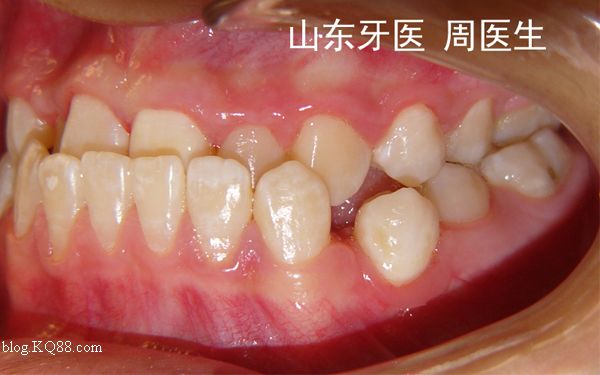 星空体育官网:库尔图瓦加盟皇马几成定局 无奈!切尔西找到新门将就放人(图4) 星空体育官网